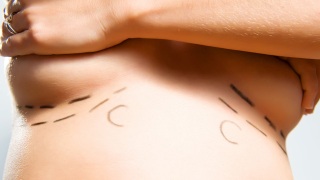 Plastic Surgery Less Popular Than 10 Years Ago